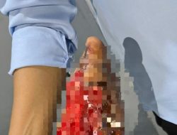 Truk Tangki Tabrak Lari di Bandar Lampung, Korban Terlantar Tanpa Biaya Perawatan